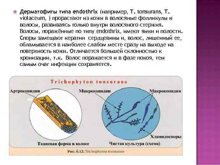 Тип поражения волос endothrix картинка