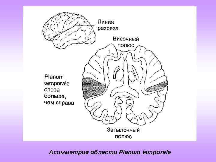 Planum temporale перевод. Planum temporale это в височной. Планум темпорале. Planum temporale череп.