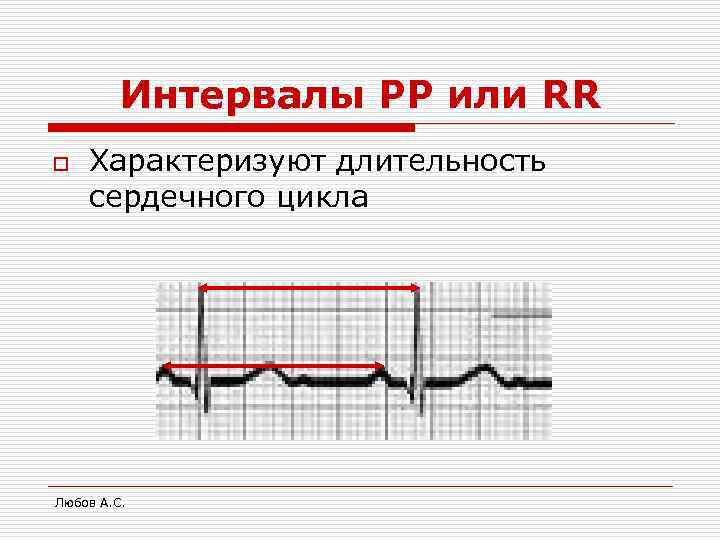 Интервалы PP или RR o Характеризуют длительность сердечного цикла Любов А. С. 