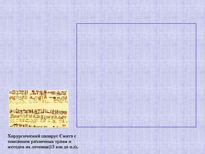 Хирургический папирус Смита с описанием различных травм и методов их лечения(13 век до н.