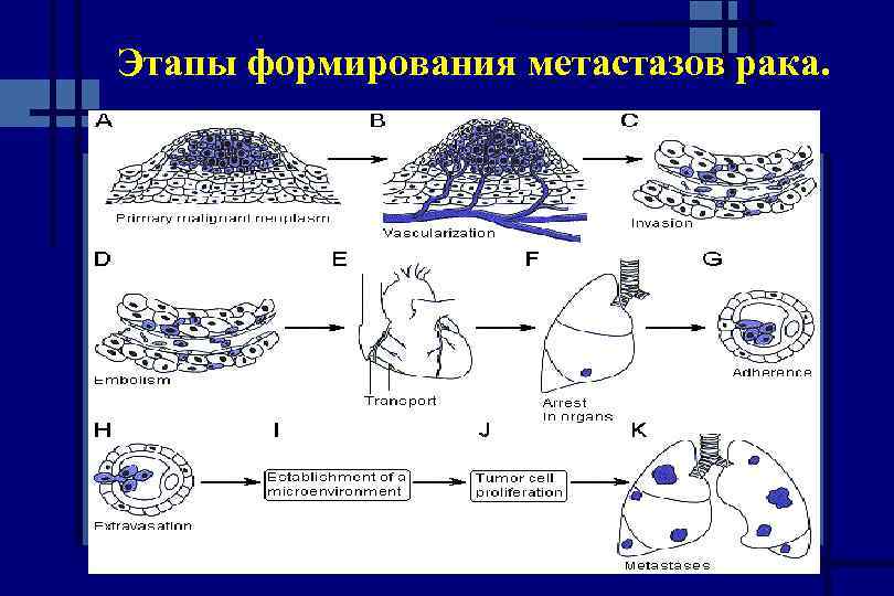 Этапы формирования метастазов рака. 