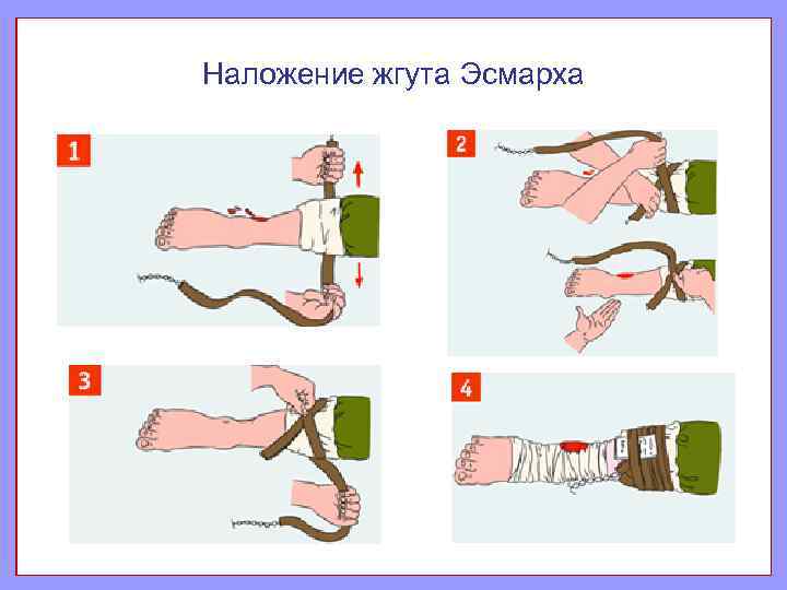 Стул при внутреннем кровотечении