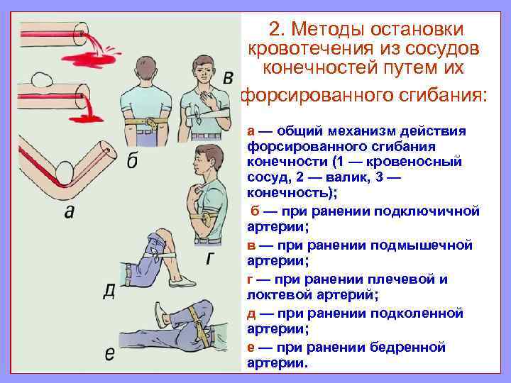 Методы остановки кровотечения презентация