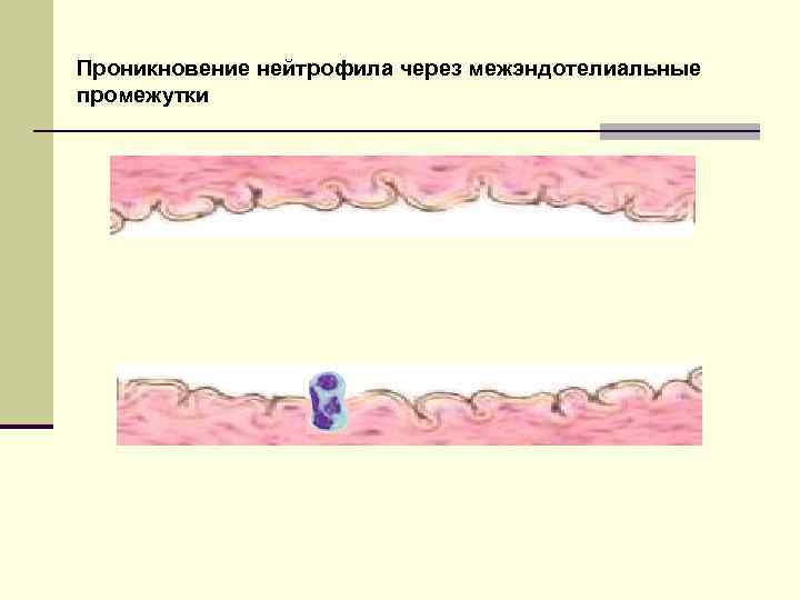 Проникновение нейтрофила через межэндотелиальные промежутки 