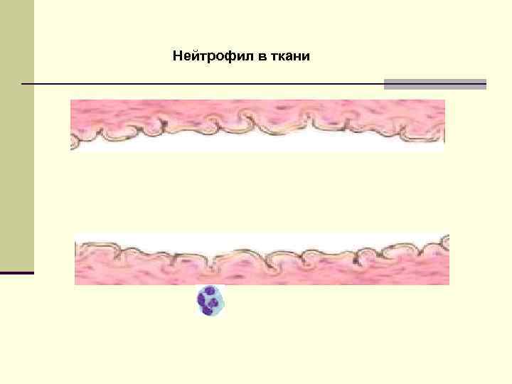 Нейтрофил в ткани 