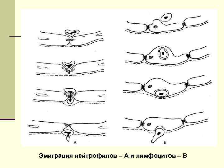 Эмиграция нейтрофилов – А и лимфоцитов – В 