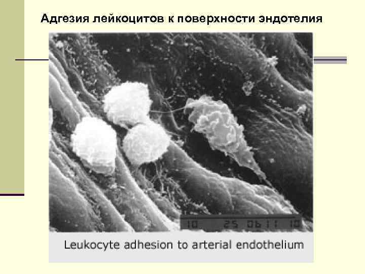 Адгезия лейкоцитов к поверхности эндотелия 
