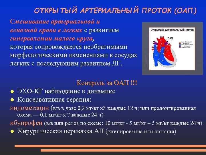 ОТКРЫТЫЙ АРТЕРИАЛЬНЫЙ ПРОТОК (ОАП) Смешивание артериальной и венозной крови в легких с развитием гиперволемии