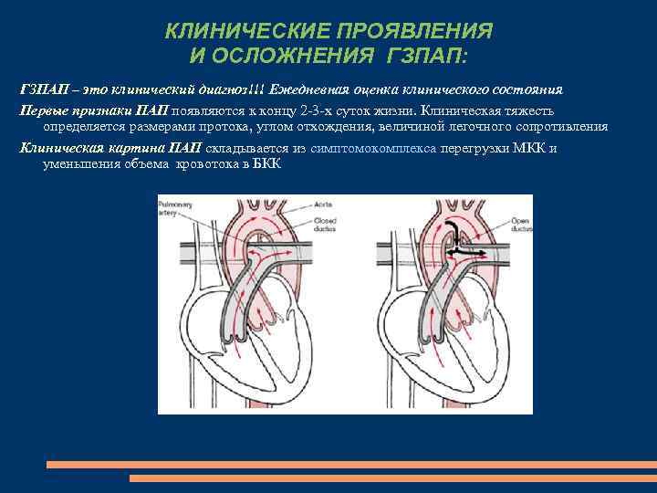 КЛИНИЧЕСКИЕ ПРОЯВЛЕНИЯ И ОСЛОЖНЕНИЯ ГЗПАП: ГЗПАП – это клинический диагноз!!! Ежедневная оценка клинического состояния