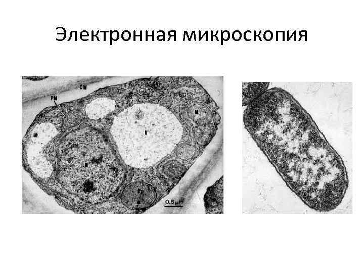 Электронная микроскопия