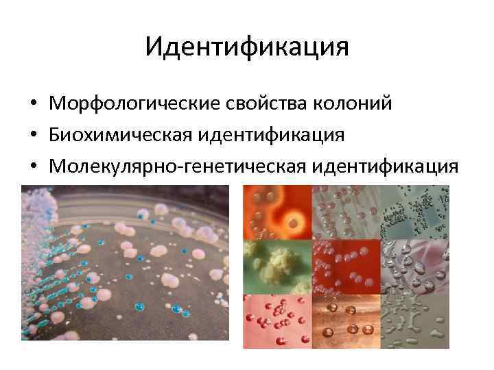 Идентификация • Морфологические свойства колоний • Биохимическая идентификация • Молекулярно-генетическая идентификация 
