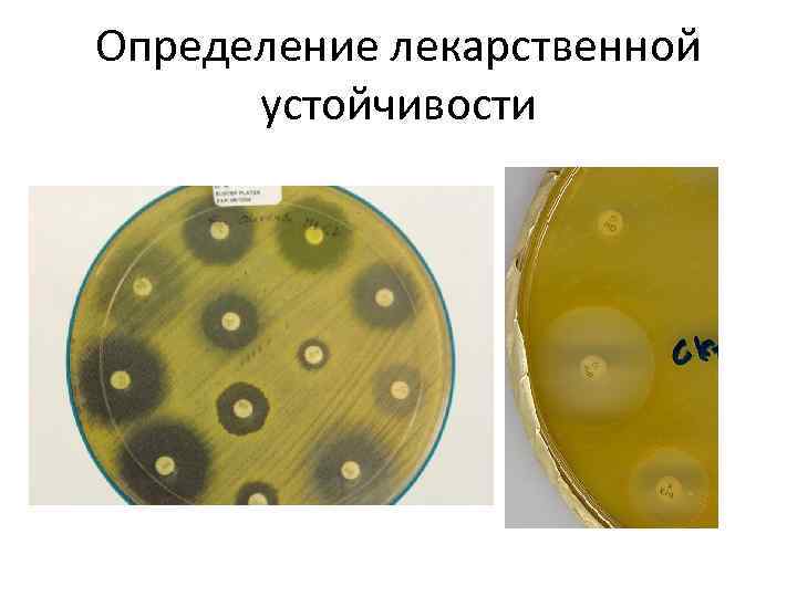 Определение лекарственной устойчивости 