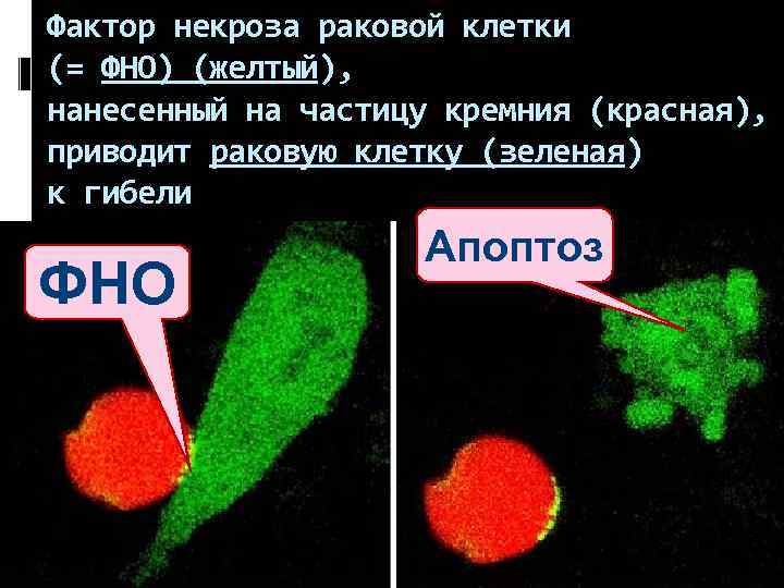 Фактор некроза раковой клетки (= ФНО) (желтый), нанесенный на частицу кремния (красная), приводит раковую