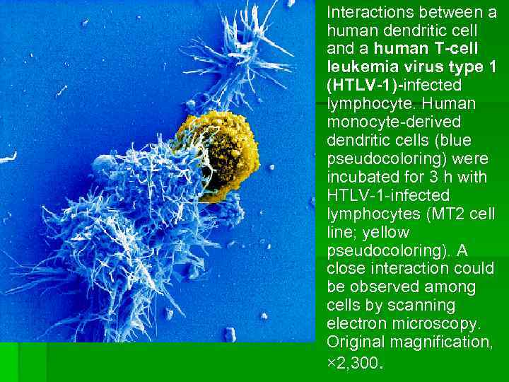 § Interactions between a human dendritic cell and a human T-cell leukemia virus type