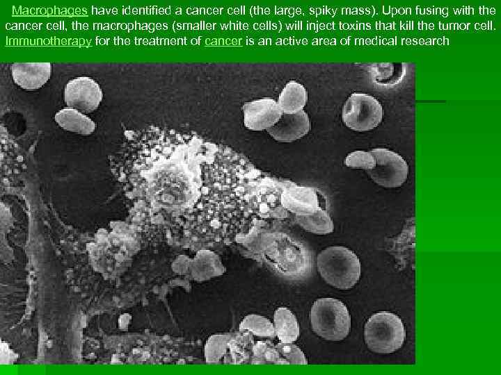  Macrophages have identified a cancer cell (the large, spiky mass). Upon fusing with