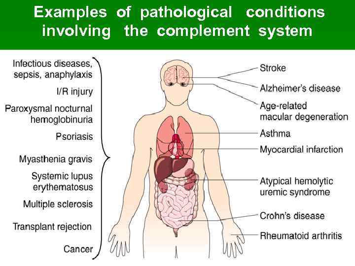 Examples of pathological conditions involving the complement system http: //www. nature. com/nbt/journal/v 25/n 11/images/nbt