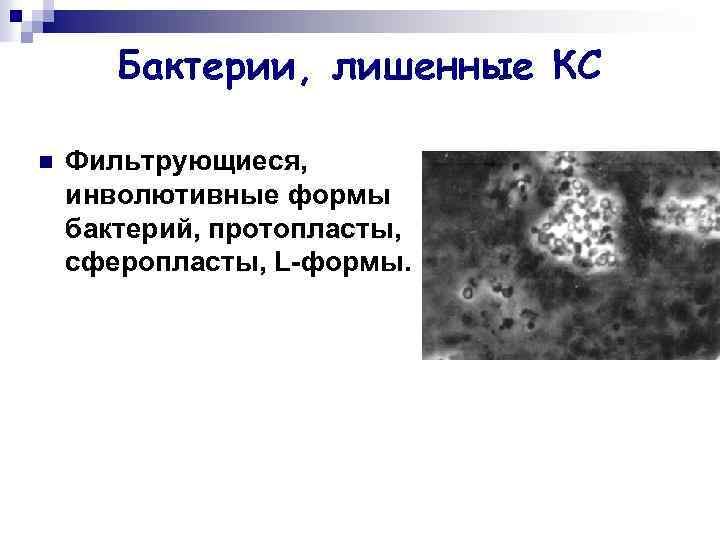 Бактерии, лишенные КС n Фильтрующиеся, инволютивные формы бактерий, протопласты, сферопласты, L-формы. 