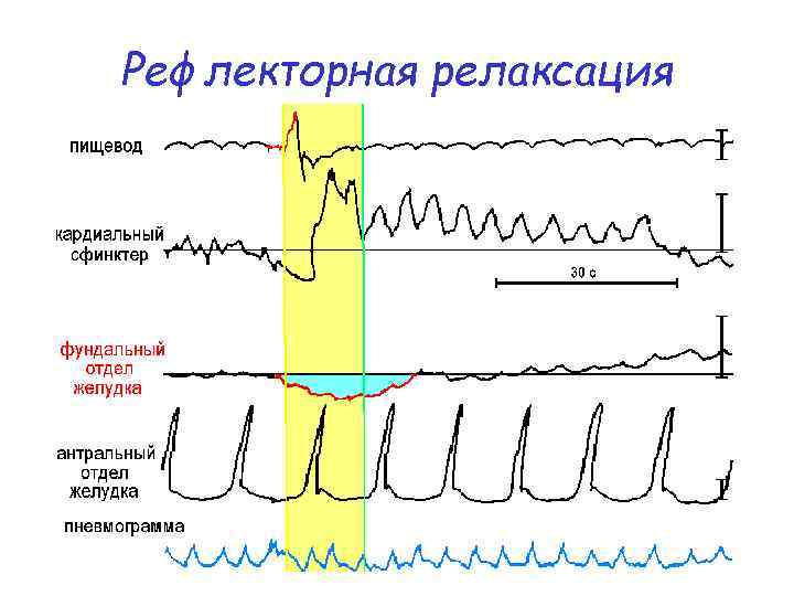 Рефлекторная релаксация 