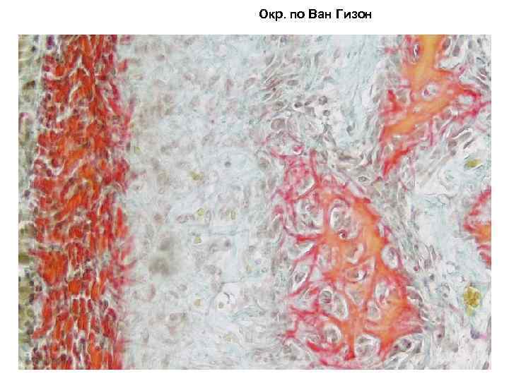Окр. по Ван Гизон 