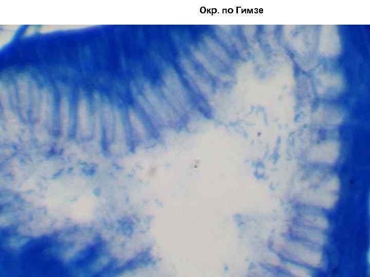 Окр. по Гимзе 