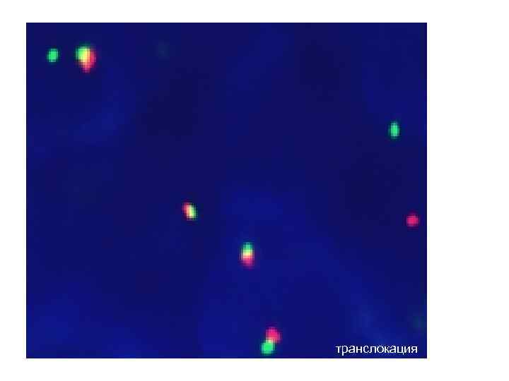транслокация 