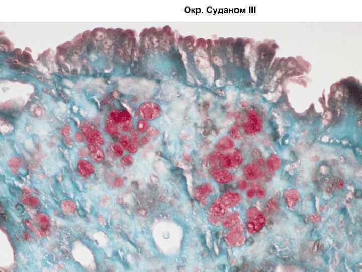 Окр. Суданом III 