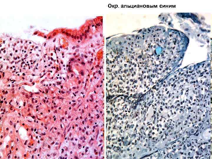Окр. альциановым синим 