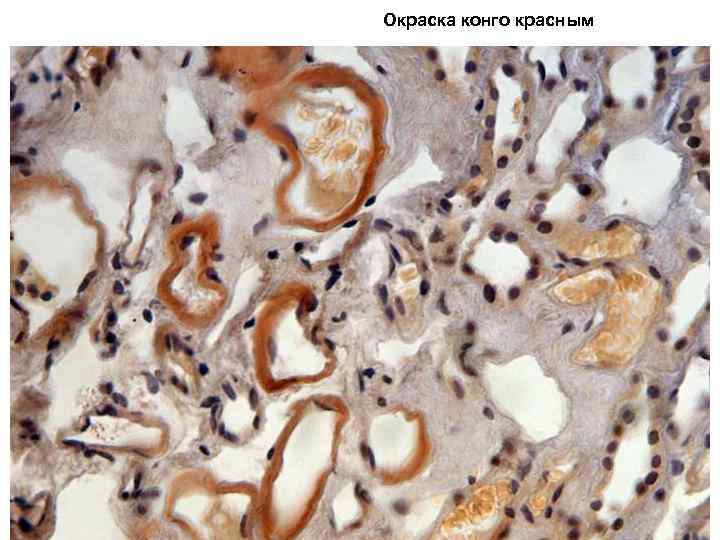 Окраска конго красным 