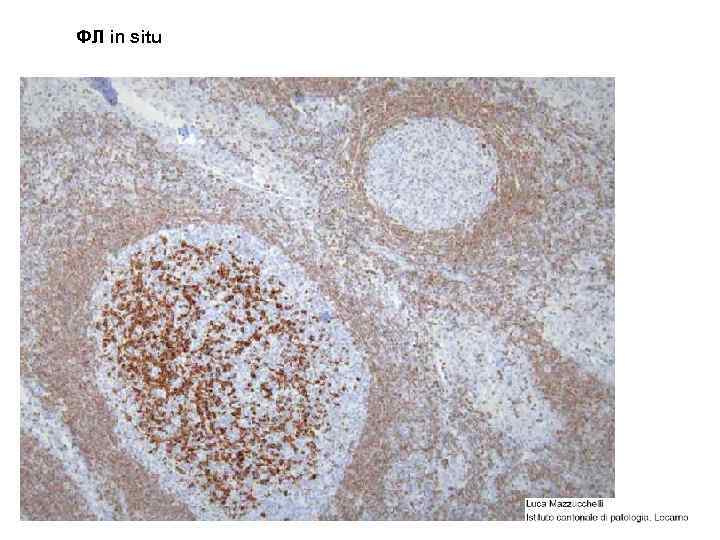 ФЛ in situ 