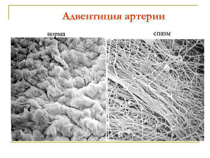 Адвентиция артерии норма спазм 