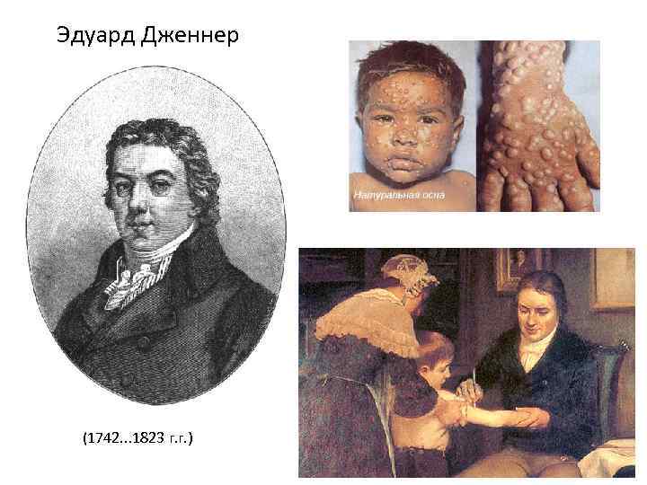 Эдуард Дженнер (1742. . . 1823 г. г. ) 