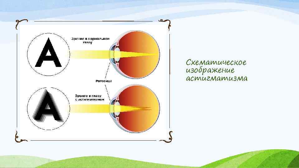 Схематическое изображение астигматизма 