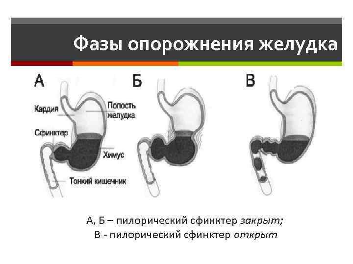 Фазы опорожнения желудка А, Б – пилорический сфинктер закрыт; В - пилорический сфинктер открыт