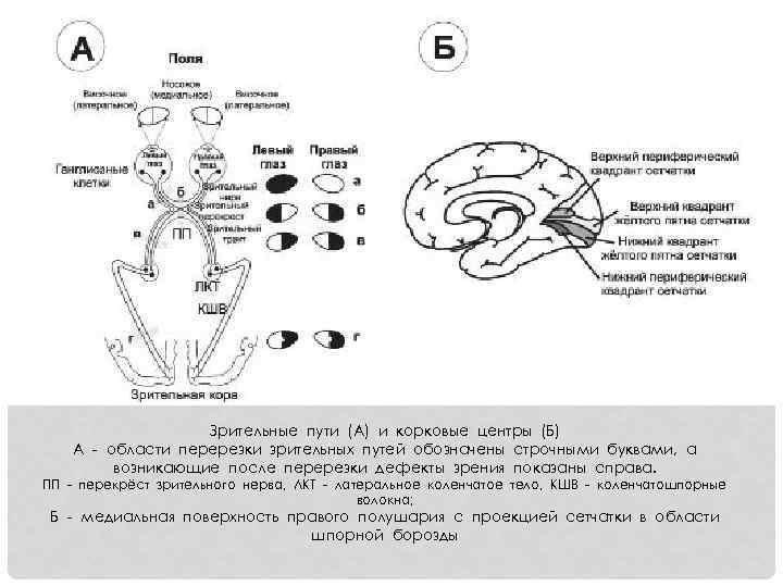 Зрительные пути (А) и корковые центры (Б) А - области перерезки зрительных путей обозначены