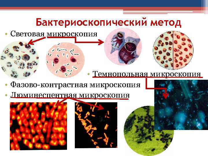 Бактериоскопический метод • Световая микроскопия • Темнопольная микроскопия • Фазово-контрастная микроскопия • Люминесцентная микроскопия