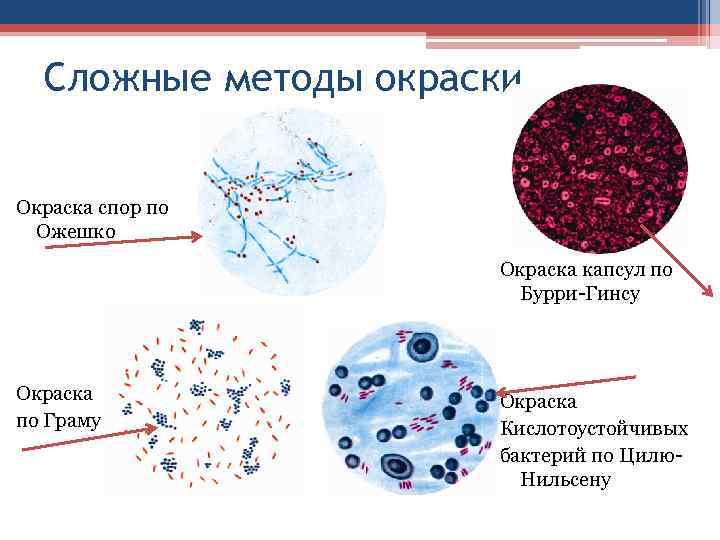 Сложные методы окраски Окраска спор по Ожешко Окраска капсул по Бурри-Гинсу Окраска по Граму