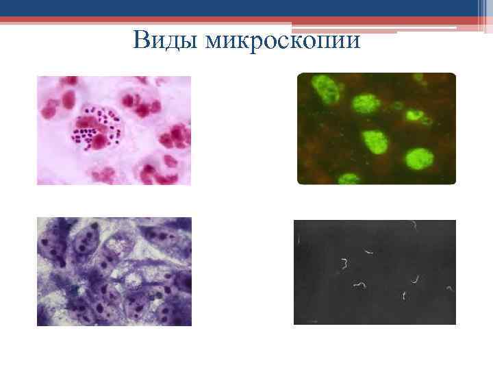 Виды микроскопии 