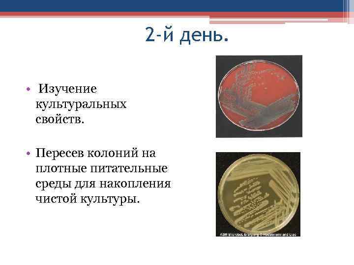 2 -й день. • Изучение культуральных свойств. • Пересев колоний на плотные питательные среды