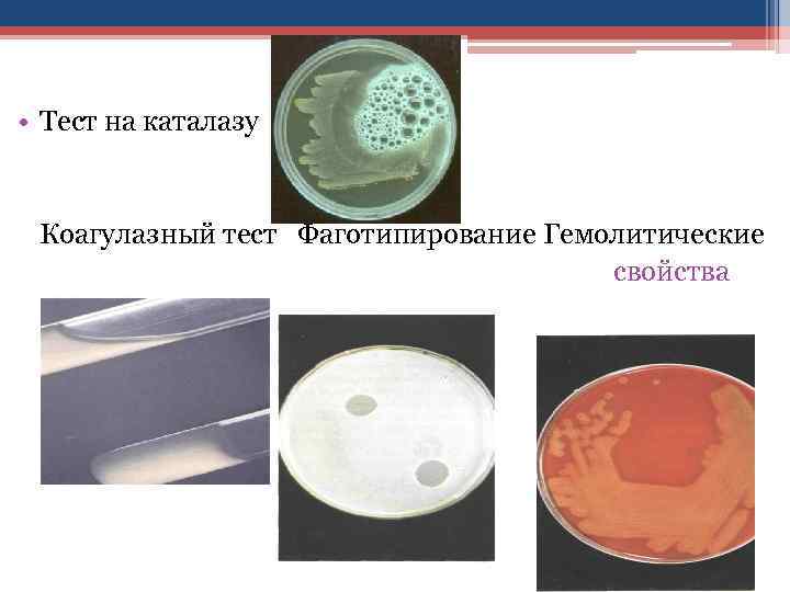  • Тест на каталазу Коагулазный тест Фаготипирование Гемолитические свойства 