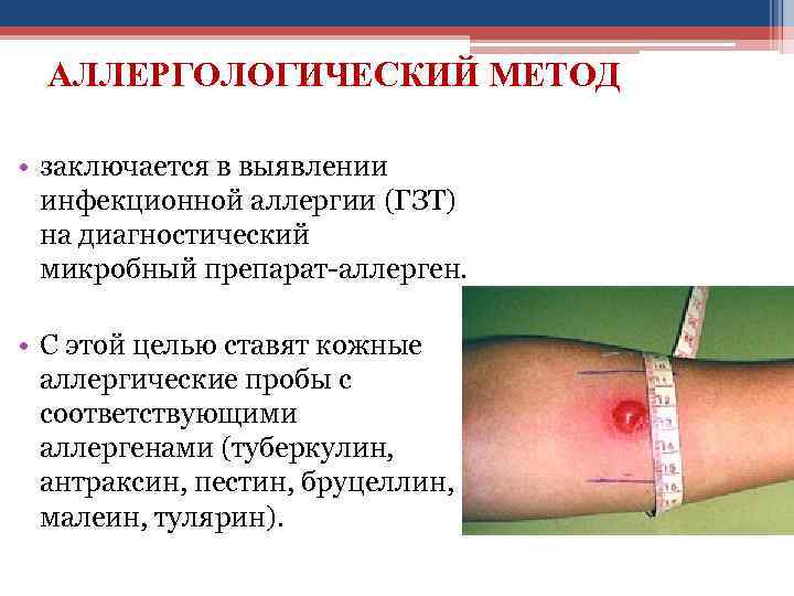 АЛЛЕРГОЛОГИЧЕСКИЙ МЕТОД • заключается в выявлении инфекционной аллергии (ГЗТ) на диагностический микробный препарат-аллерген. •