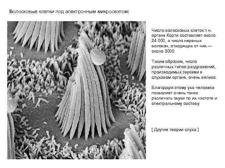 Волосковые клетки под электронным микроскопом: Число волосковых клеток т. н. органа Корти составляет около