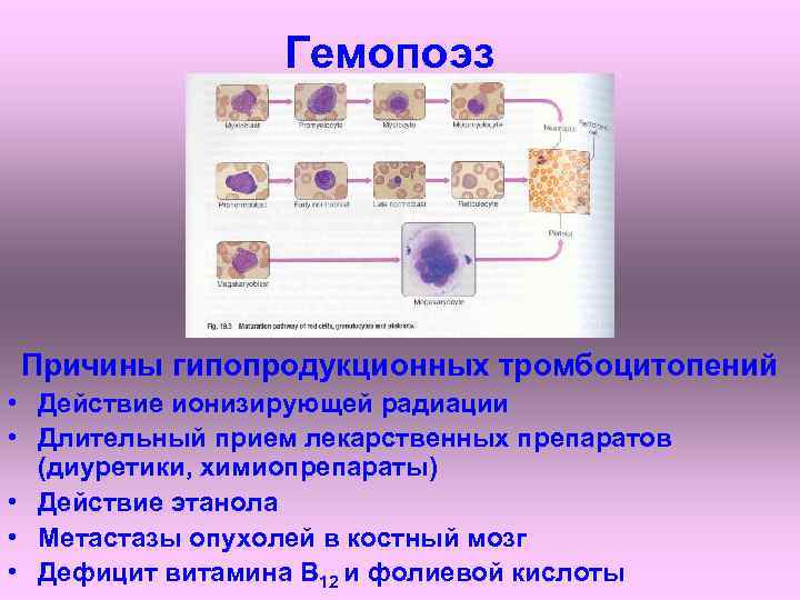 Гемопоэз Причины гипопродукционных тромбоцитопений • Действие ионизирующей радиации • Длительный прием лекарственных препаратов (диуретики,