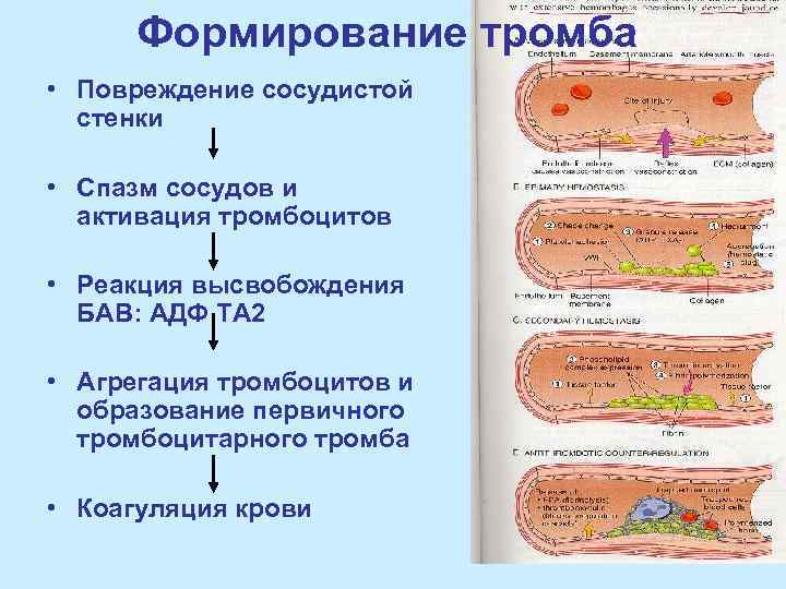 Формирование тромба • Повреждение сосудистой стенки • Спазм сосудов и активация тромбоцитов • Реакция