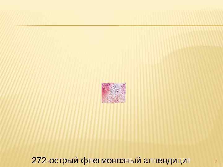 272 -острый флегмонозный аппендицит 3 