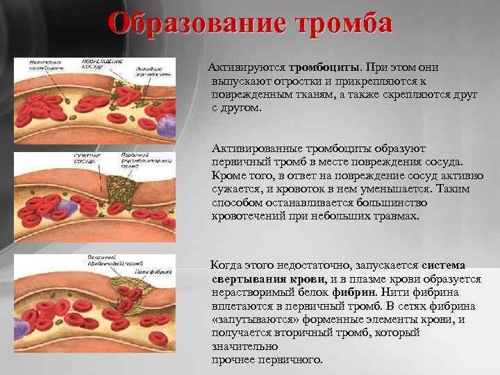 Образование тромба Активируются тромбоциты. При этом они выпускают отростки и прикрепляются к поврежденным тканям,
