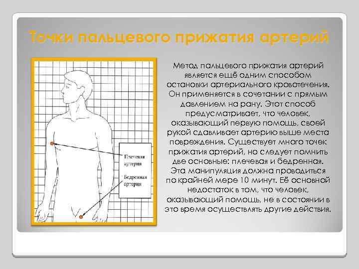 Точки пальцевого прижатия артерий Метод пальцевого прижатия артерий является ещё одним способом остановки артериального