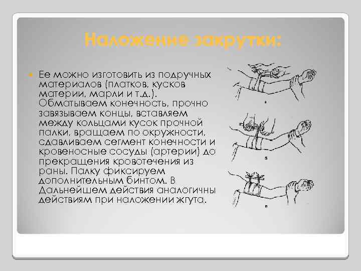 Наложение закрутки: Ее можно изготовить из подручных материалов (платков, кусков материи, марли и т.