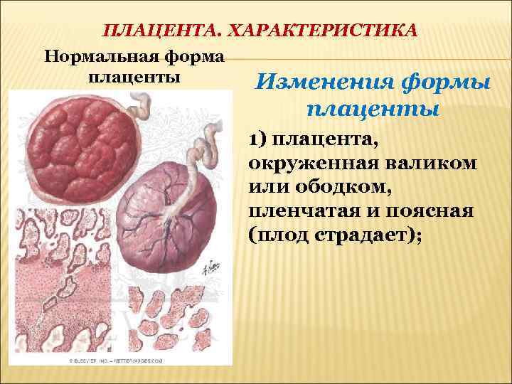 ПЛАЦЕНТА. ХАРАКТЕРИСТИКА Нормальная форма плаценты Изменения формы плаценты 1) плацента, окруженная валиком или ободком,