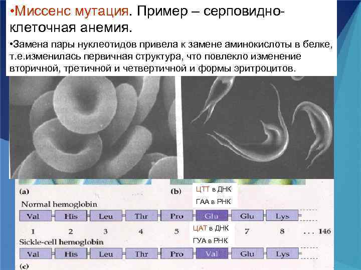 Кариотип эритроцит. Серповидная клеточная анемия гемоглобин. Серповидноклеточная анемия ретикулоциты. Серповидноклеточная анемия замещение. Серповидноклеточная анемия распространенность.