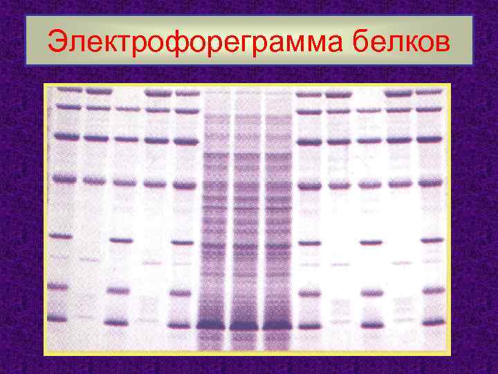 Электрофореграмма белков 